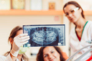 Root Canal Mesa AZ | Tempe | Gilbert | Phoenix