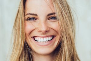 Smile Makeover | Drs of Smiles | Mesa AZ