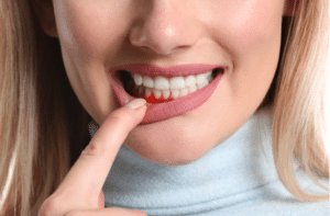 Woman with gum inflammation, closeup