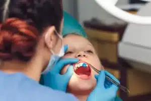 fluoride dental hygiene 768x512.jpg